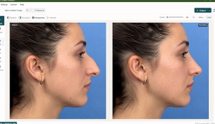 Plastic Surgery Simulator - Screenshot 2